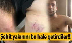 Yenişehir ilçesinde polis şehit yakını darp etti iddiası