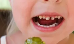 Okul çağındaki çocuklarda çürük riskine dikkat!