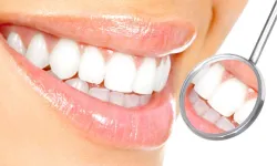 Diş kanaması orucu bozar mı? Diş eti kanaması orucu bozar mı?