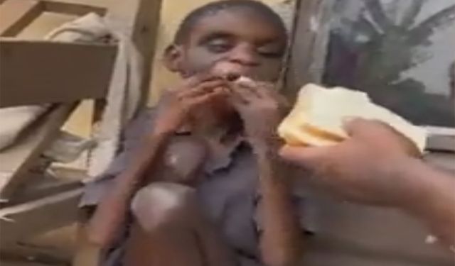 Kahreden görüntü Afrikalı çocuğun görüntüsü gözyaşlarına boğdu