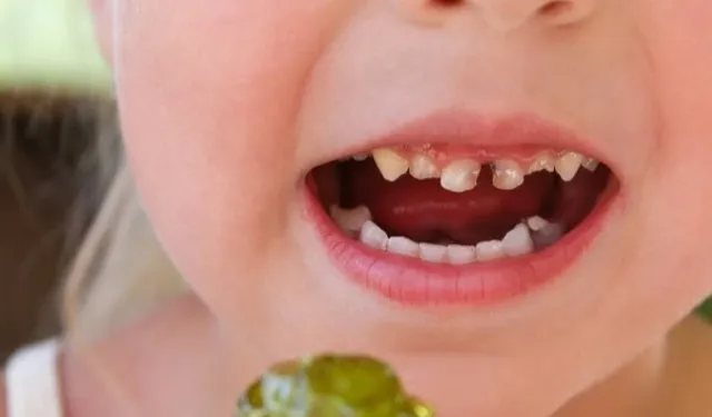 Okul çağındaki çocuklarda çürük riskine dikkat!
