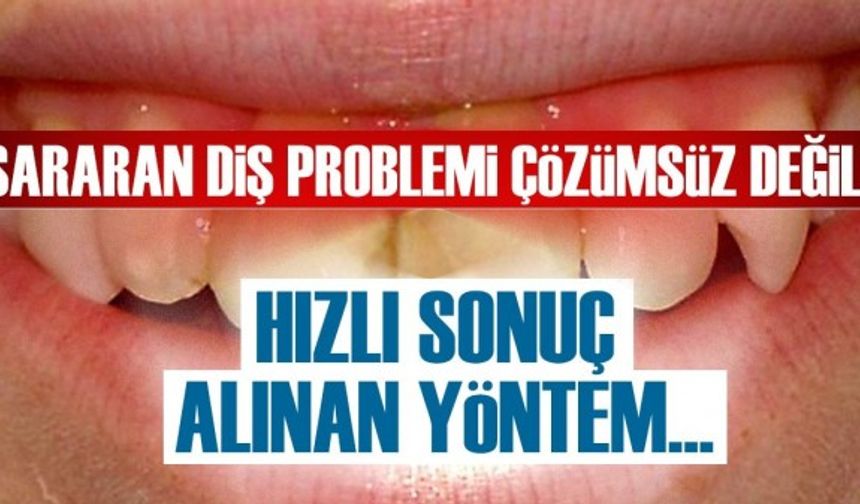 Sararan diş problemi çözümsüz değil