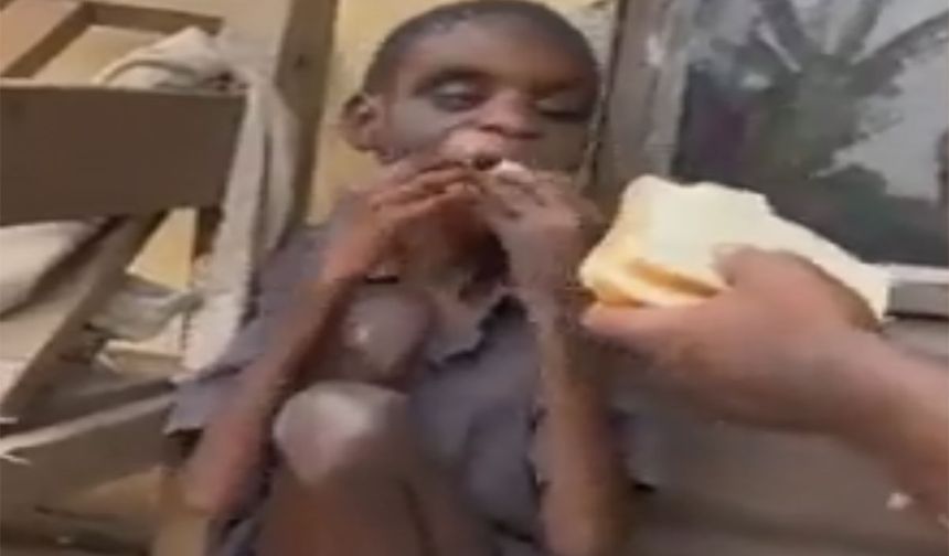 Kahreden görüntü Afrikalı çocuğun görüntüsü gözyaşlarına boğdu